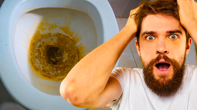 Say Goodbye to Toilet Stains: Affordable Hard Water Solution!